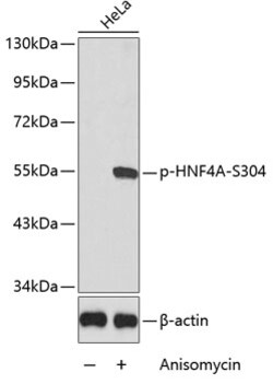 Invitrogen Phospho-HNF4A (Ser304) Polyclonal Antibody 100 &mu;L | Buy Online | Invitrogen&trade; | Fisher Scientific