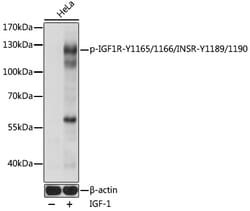 Invitrogen Phospho-IR/IGF1R (Tyr1165, Tyr1166, Tyr1189, Tyr1190) Polyclonal