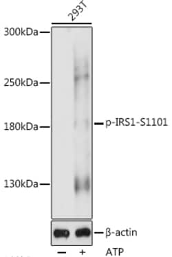 Invitrogen Phospho-IRS1 (Ser1101) Polyclonal Antibody 100 &mu;L; Unconjugated:Antibodies,