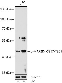Phospho-MAP2K4 (Ser257, Thr261) Polyclonal Antibody:Antibodies, Polyclonal