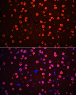 Invitrogen Phospho-p38 MAPK alpha (Thr180, Tyr182) Polyclonal Antibody