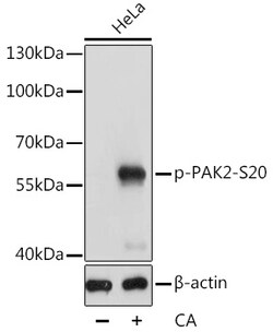 Invitrogen Phospho-PAK2 (Ser20) Polyclonal Antibody 100 &mu;L | Buy Online | Invitrogen&trade; | Fisher Scientific