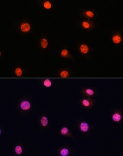 Invitrogen Phospho-SMAD2/SMAD3 (Ser465, Ser467, Ser423, Ser425) Polyclonal
