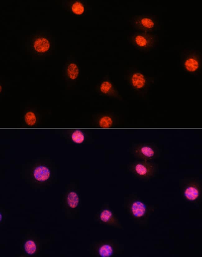 Invitrogen Phospho-SMAD2/SMAD3 (Ser465, Ser467, Ser423