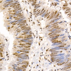 Invitrogen Phospho-SMAD2/SMAD3 (Ser465, Ser467, Ser423, Ser425) Polyclonal