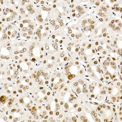 Invitrogen Phospho-SMAD2/SMAD3 (Ser465, Ser467, Ser423, Ser425) Polyclonal