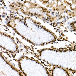 Invitrogen Phospho-STAT6 (Tyr641) Polyclonal Antibody 100 &mu;L; Unconjugated:Antibodies,