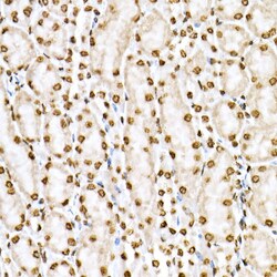 Invitrogen Phospho-STAT6 (Tyr641) Polyclonal Antibody 100 &mu;L; Unconjugated:Antibodies,