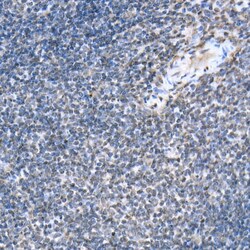 Invitrogen Phospho-STAT6 (Tyr641) Polyclonal Antibody 100 &mu;L; Unconjugated:Antibodies,