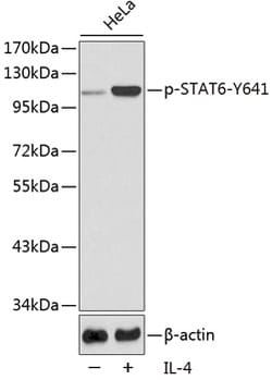 Invitrogen Phospho-STAT6 (Tyr641) Polyclonal Antibody 100 &mu;L; Unconjugated:Antibodies,