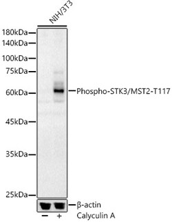 Invitrogen Phospho-MST2 (Thr117) Polyclonal Antibody 100 &mu;L; Unconjugated:Antibodies,