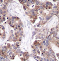 Invitrogen Phospho-Stathmin 1 (Ser25) Polyclonal Antibody 100 &mu;L; Unconjugated:Antibodies,