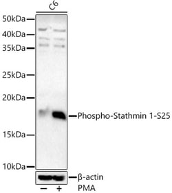 Invitrogen Phospho-Stathmin 1 (Ser25) Polyclonal Antibody 100 &mu;L; Unconjugated:Antibodies,