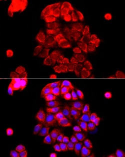 Invitrogen PI4KB Polyclonal Antibody 100 μL; Unconjugated:Antibodies,
