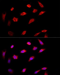 Invitrogen PI4KB Polyclonal Antibody 100 μL; Unconjugated:Antibodies,