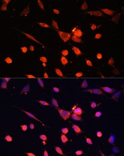 Invitrogen PI3K p55 gamma Polyclonal Antibody 100 &mu;L; Unconjugated:Antibodies,