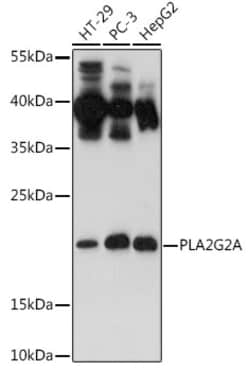 Invitrogen PLA2G2A Polyclonal Antibody 100 &mu;L; Unconjugated:Antibodies,