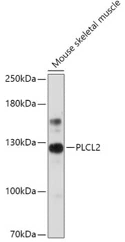 Invitrogen PLCL2 Polyclonal Antibody 100 &mu;L; Unconjugated:Antibodies,
