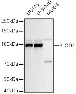 Invitrogen PLOD2 Polyclonal Antibody 100 μL; Unconjugated:Antibodies,