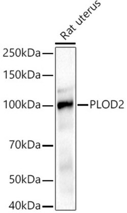 Invitrogen PLOD2 Polyclonal Antibody 100 μL; Unconjugated:Antibodies,