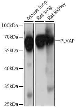 Invitrogen PLVAP Polyclonal Antibody 100 μL; Unconjugated:Antibodies,