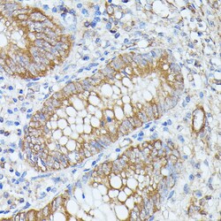 Invitrogen PNLIPRP1 Polyclonal Antibody 100 &mu;L | Buy Online | Invitrogen&trade; | Fisher Scientific
