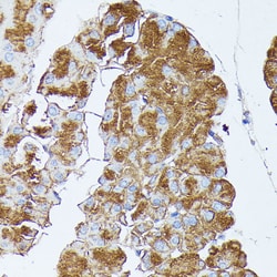 Invitrogen PNLIPRP1 Polyclonal Antibody 100 &mu;L | Buy Online | Invitrogen&trade; | Fisher Scientific
