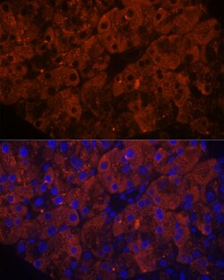 Invitrogen PNLIPRP1 Polyclonal Antibody 100 &mu;L | Buy Online | Invitrogen&trade; | Fisher Scientific