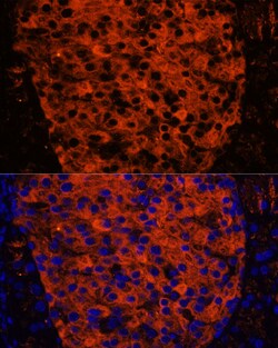 Invitrogen PNLIPRP1 Polyclonal Antibody 100 &mu;L | Buy Online | Invitrogen&trade; | Fisher Scientific