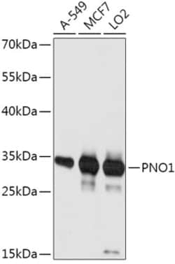 Invitrogen PNO1 Polyclonal Antibody 100 &mu;L; Unconjugated:Antikroppar