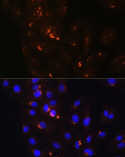 Invitrogen POFUT2 Polyclonal Antibody 100 &mu;L; Unconjugated:Antibodies,