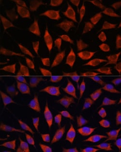 Invitrogen POGLUT1 Polyclonal Antibody 100 &mu;L; Unconjugated:Antibodies,