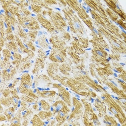 Invitrogen POLG2 Polyclonal Antibody 100 &mu;L; Unconjugated:Antibodies,