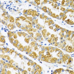 Invitrogen POLG2 Polyclonal Antibody 100 &mu;L; Unconjugated:Antibodies,