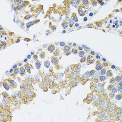 Invitrogen POLG2 Polyclonal Antibody 100 &mu;L; Unconjugated:Antibodies,