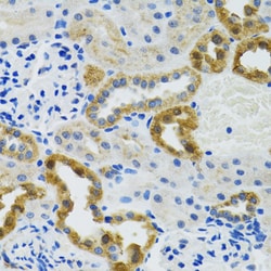 Invitrogen POLG2 Polyclonal Antibody 100 &mu;L; Unconjugated:Antibodies,