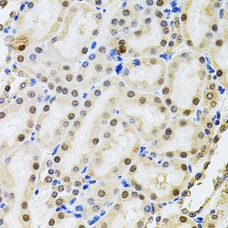 Invitrogen POP4 Polyclonal Antibody 100 &mu;L; Unconjugated:Antibodies,