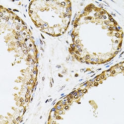Invitrogen POP4 Polyclonal Antibody 100 &mu;L; Unconjugated:Antibodies,