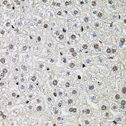 Invitrogen POP4 Polyclonal Antibody 100 &mu;L; Unconjugated:Antibodies,