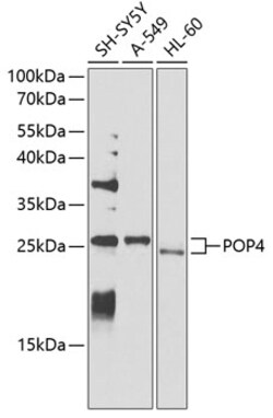 Invitrogen POP4 Polyclonal Antibody 100 &mu;L; Unconjugated:Antibodies,