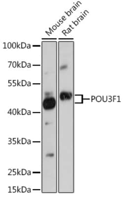 Invitrogen OCT6 Polyclonal Antibody 100 &mu;L; Unconjugated:Antibodies,