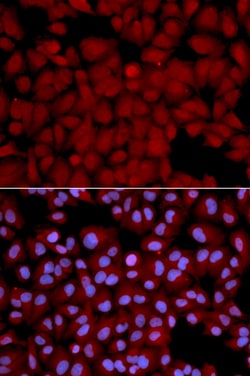 Invitrogen PPP1CB Polyclonal Antibody 100 μL; Unconjugated:Antibodies,