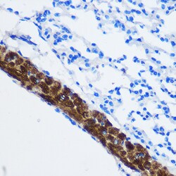 Invitrogen PPP1CB Polyclonal Antibody 100 μL; Unconjugated:Antibodies,