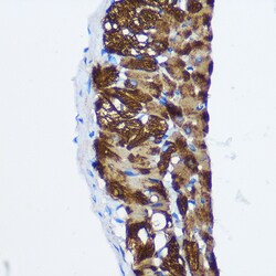 Invitrogen PPP1CB Polyclonal Antibody 100 μL; Unconjugated:Antibodies,