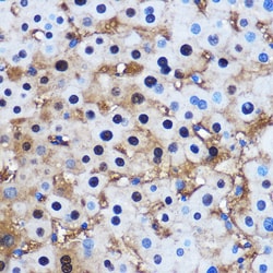 Invitrogen PPP1CB Polyclonal Antibody 100 μL; Unconjugated:Antibodies,