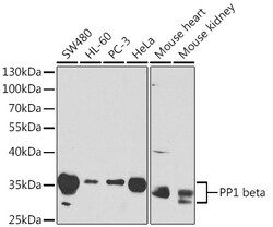 Invitrogen PPP1CB Polyclonal Antibody 100 μL; Unconjugated:Antibodies,