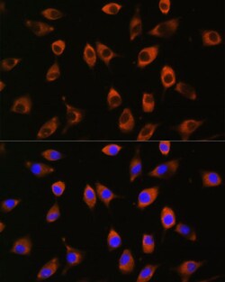 Invitrogen PPP1R9B Polyclonal Antibody 100 &mu;L; Unconjugated:Antibodies,
