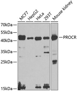 Invitrogen PROCR Polyclonal Antibody 100 &mu;L; Unconjugated:Antibodies,