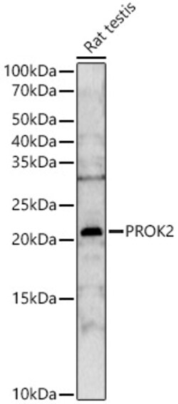 Invitrogen PROK2 Polyclonal Antibody 100 &mu;L | Buy Online | Invitrogen&trade; | Fisher Scientific