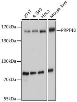 Invitrogen PRPF4B Polyclonal Antibody 100 &mu;L; Unconjugated:Antibodies,